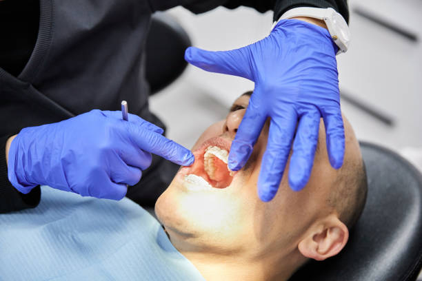 Best Root Canal Emergency Dentist  in Peshtigo, WI